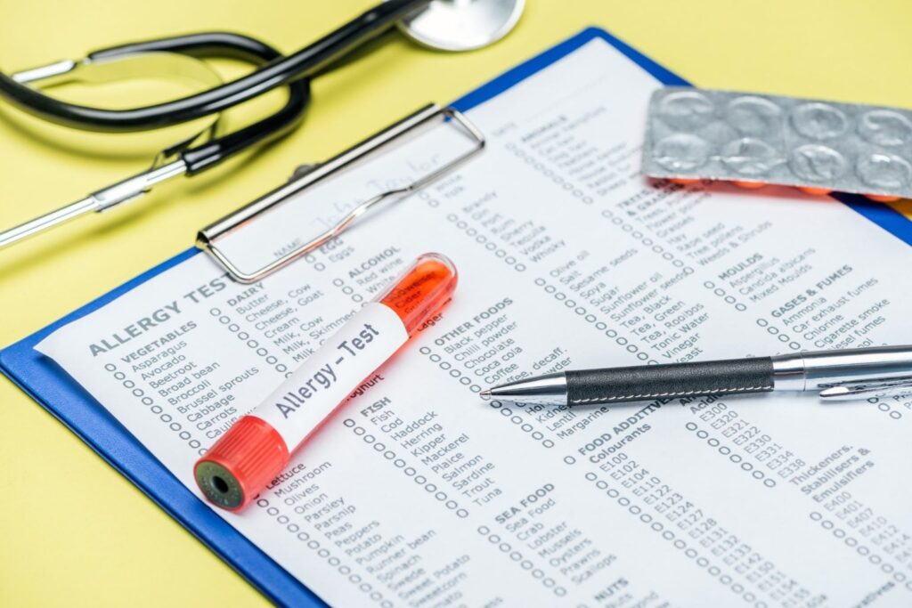 test tube and pen on allergy test results near stethoscope on yellow 1536x1025 1